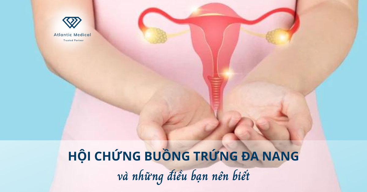 Hội chứng buồng trứng đa nang và những điều bạn nên biết