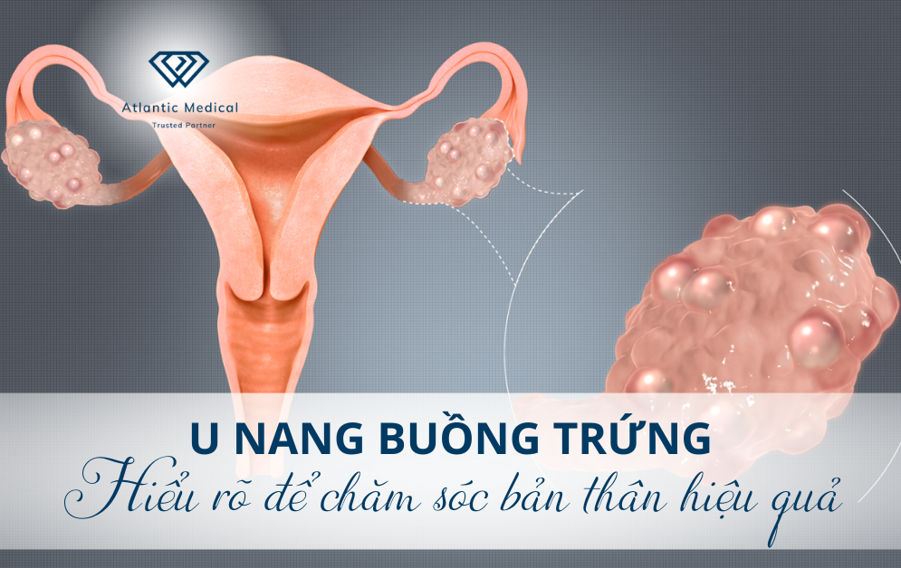 U nang buồng trứng - Hiểu rõ để chăm sóc bản thân hiệu quả