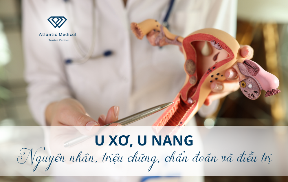 Tìm hiểu về u xơ và u nang - Nguyên nhân, triệu chứng, chẩn đoán và điều trị