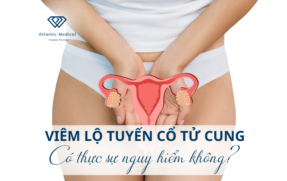 Viêm lộ tuyến cổ tử cung - Có thực sự nguy hiểm không?