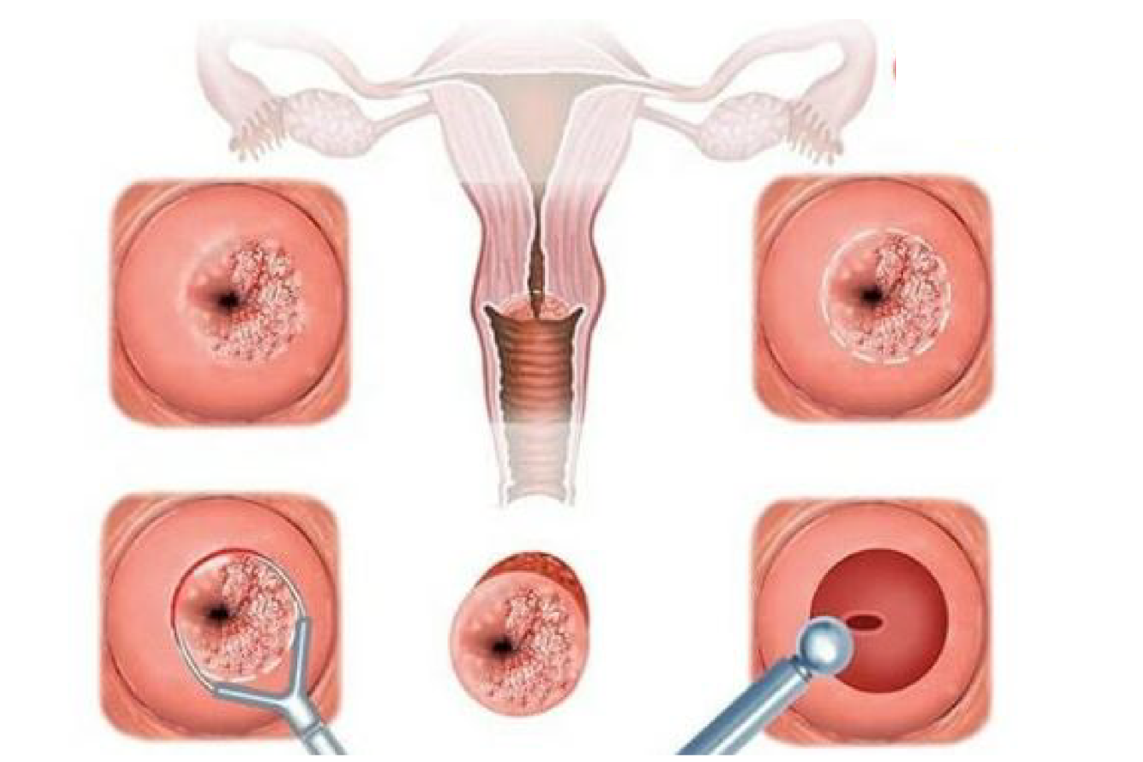 Bác sĩ thăm khám và điều trị tình trạng viêm tùy theo từng cấp độ 