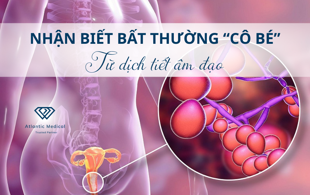 Nhận biết bất thường “cô bé” từ dịch tiết âm đạo